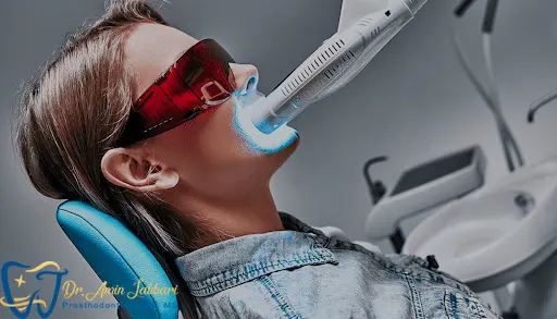 آمادگی قبل از سفید کردن دندان با لیزر